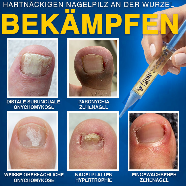 up✅ Fungi Free Bienengift Nagelpilz Behandlung – Intensive Pflege für gesünder aussehende Nägel💅