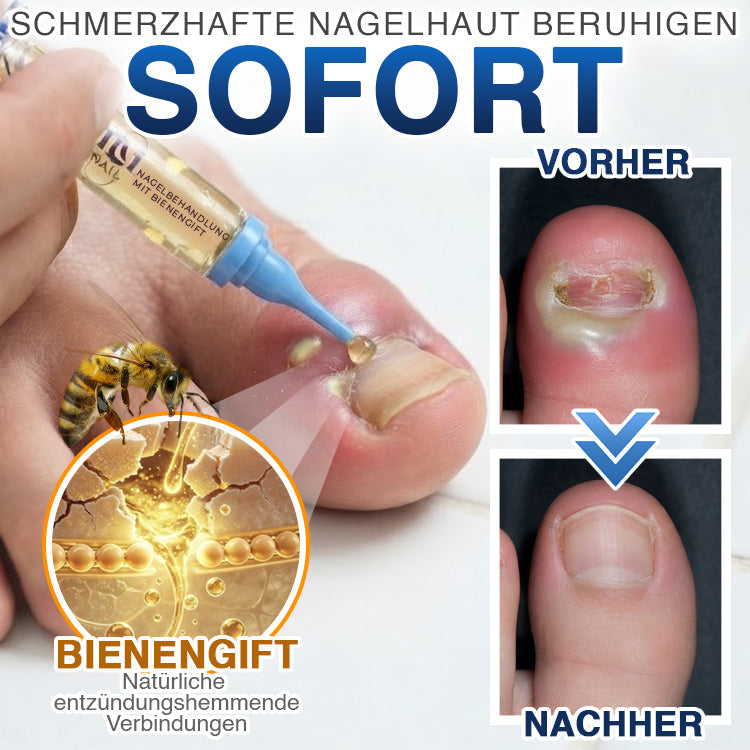 up✅ Fungi Free Bienengift Nagelpilz Behandlung – Intensive Pflege für gesünder aussehende Nägel💅