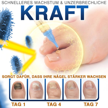 up✅ Fungi Free Bienengift Nagelpilz Behandlung – Intensive Pflege für gesünder aussehende Nägel💅