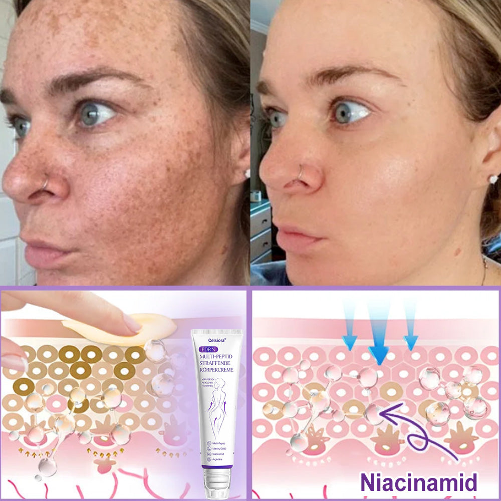 up Celsiora® PDRN Multi-Peptide Körpercreme gegen Falten, schlaffe Haut, Dehnungsstreifen & Cellulite