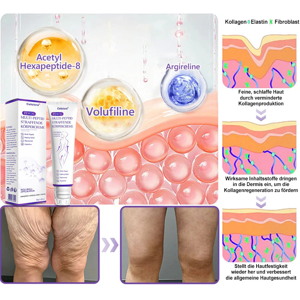 up Celsiora® PDRN Multi-Peptide Körpercreme gegen Falten, schlaffe Haut, Dehnungsstreifen & Cellulite