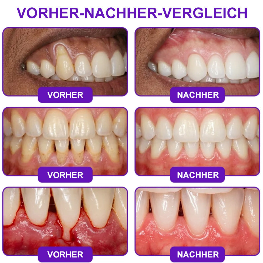 😁Celsiora® GingivaCare Zahnpasta mit Bienengift – Intensive Zahnfleischpflege bei Gingivitis & Parodontitis