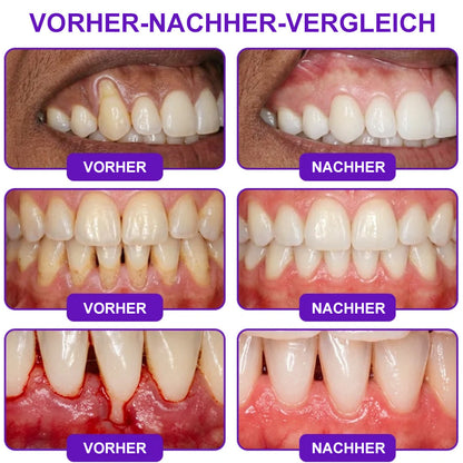 😁Celsiora® GingivaCare Zahnpasta mit Bienengift – Intensive Zahnfleischpflege bei Gingivitis & Parodontitis