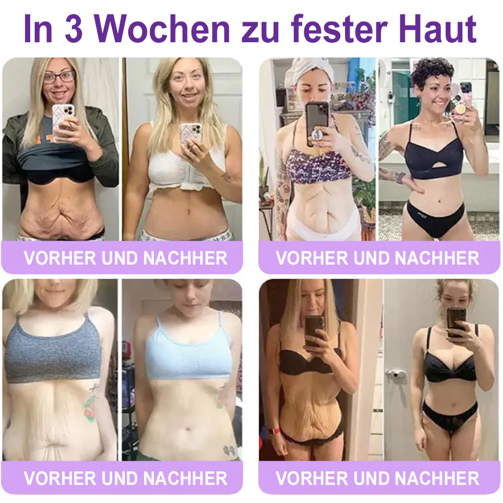 up Celsiora® PDRN Multi-Peptide Körpercreme gegen Falten, schlaffe Haut, Dehnungsstreifen & Cellulite