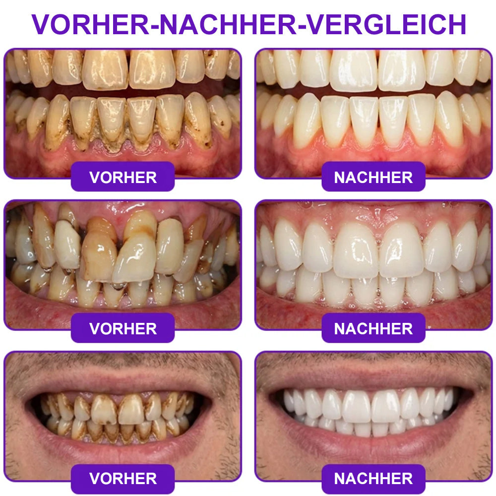 😁Celsiora® GingivaCare Zahnpasta mit Bienengift – Intensive Zahnfleischpflege bei Gingivitis & Parodontitis