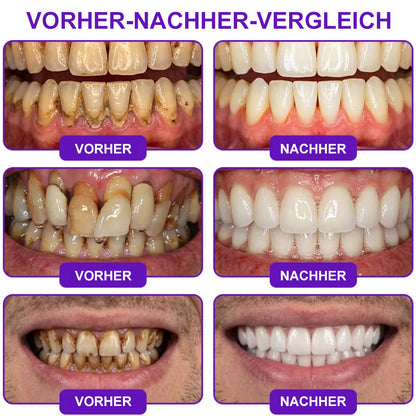 😁Celsiora® GingivaCare Zahnpasta mit Bienengift – Intensive Zahnfleischpflege bei Gingivitis & Parodontitis