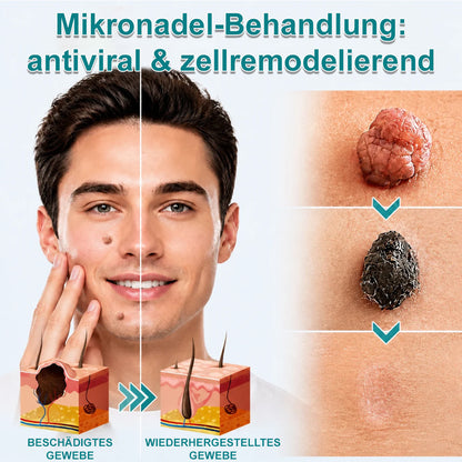up Celsiora® 2-in-1 Microneedle & Hydrocolloid Patch