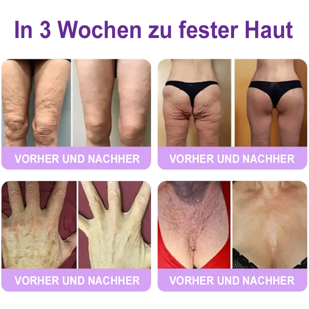 up Celsiora® PDRN Multi-Peptide Körpercreme gegen Falten, schlaffe Haut, Dehnungsstreifen & Cellulite