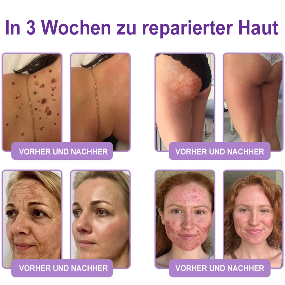 up Celsiora® PDRN Multi-Peptide Körpercreme gegen Falten, schlaffe Haut, Dehnungsstreifen & Cellulite