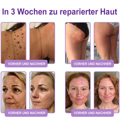 up Celsiora® PDRN Multi-Peptide Körpercreme gegen Falten, schlaffe Haut, Dehnungsstreifen & Cellulite