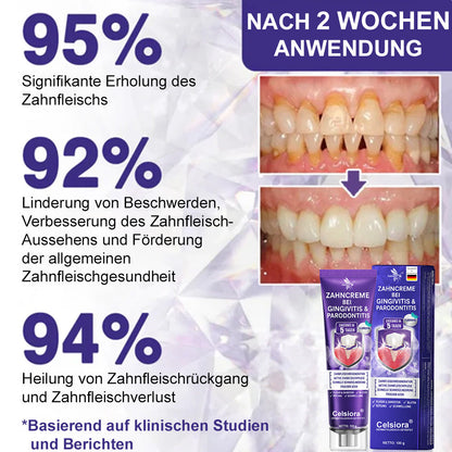 😁Celsiora® GingivaCare Zahnpasta mit Bienengift – Intensive Zahnfleischpflege bei Gingivitis & Parodontitis