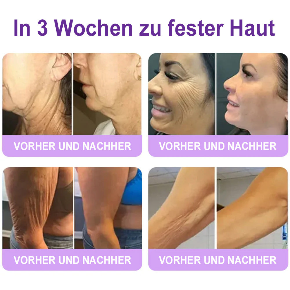 up Celsiora® PDRN Multi-Peptide Körpercreme gegen Falten, schlaffe Haut, Dehnungsstreifen & Cellulite