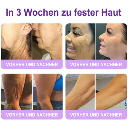 up Celsiora® PDRN Multi-Peptide Körpercreme gegen Falten, schlaffe Haut, Dehnungsstreifen & Cellulite