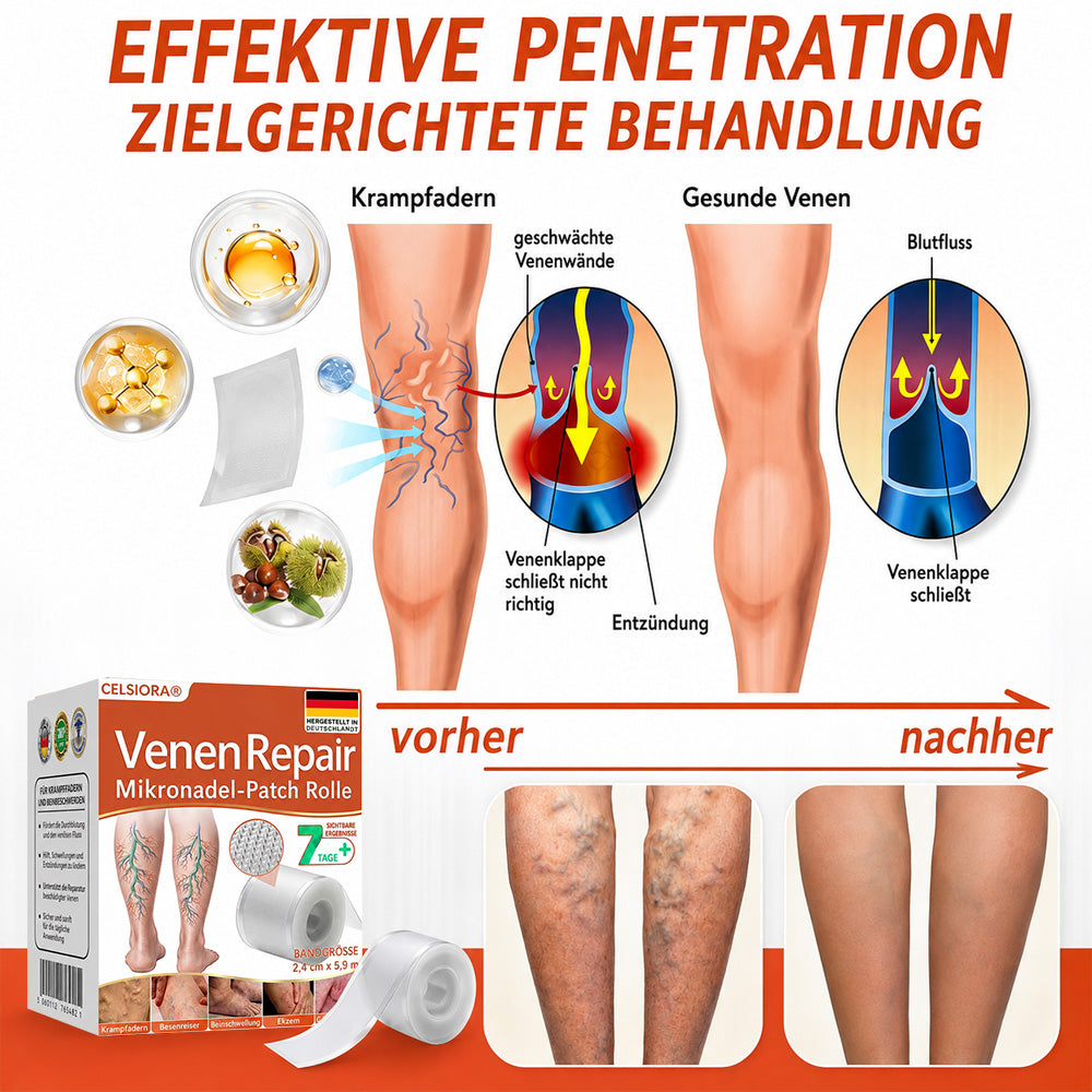 Celsiora® Vein Ease Microneedle-Pflegepflaster – Bei Besenreisern, Krampfadern, Schwellungen & müden Beinen | Nur heute 50 % Rabatt
