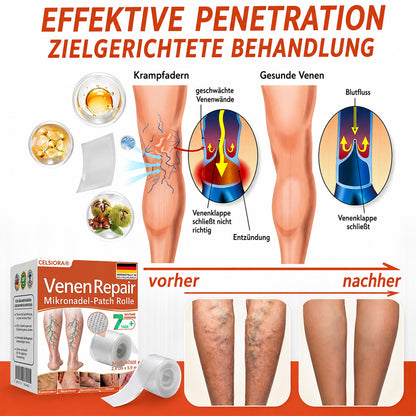 Celsiora® Vein Ease Microneedle-Pflegepflaster – Bei Besenreisern, Krampfadern, Schwellungen & müden Beinen | Nur heute 50 % Rabatt