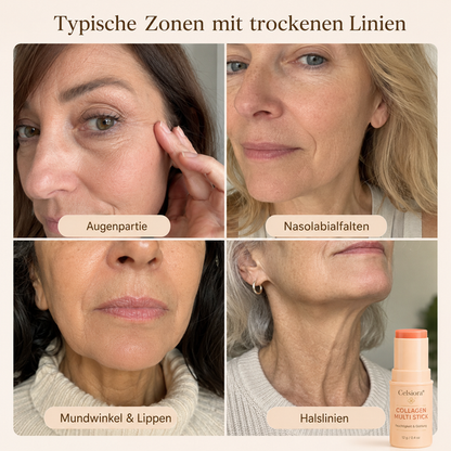 up🌿Celsiora® Kollagen-Pflegestift mit PDRN – Sofortpflege für Trockenheitsfältchen