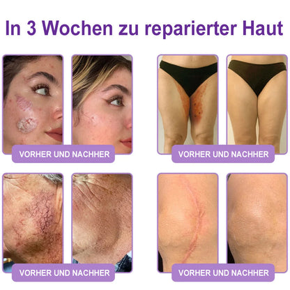 up Celsiora® PDRN Multi-Peptide Körpercreme gegen Falten, schlaffe Haut, Dehnungsstreifen & Cellulite