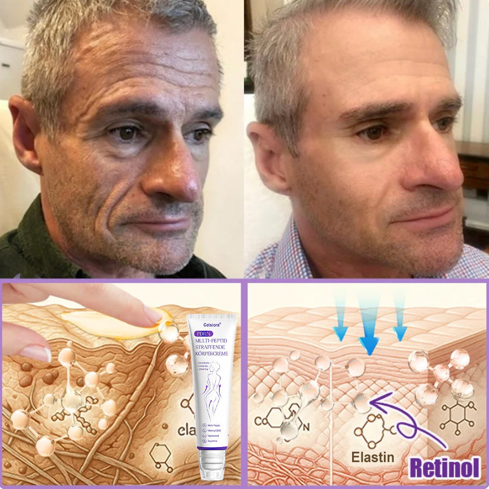 up Celsiora® PDRN Multi-Peptide Körpercreme gegen Falten, schlaffe Haut, Dehnungsstreifen & Cellulite