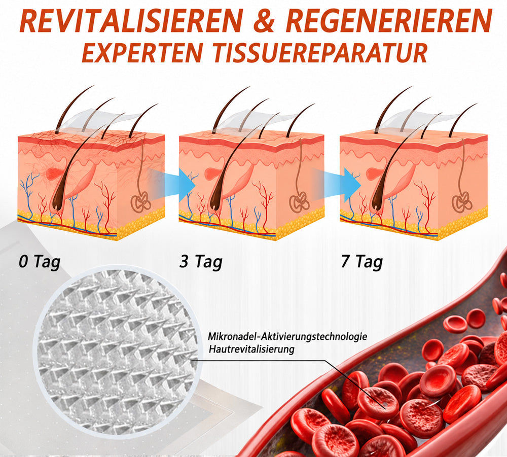 Celsiora® Vein Ease Microneedle-Pflegepflaster – Bei Besenreisern, Krampfadern, Schwellungen & müden Beinen | Nur heute 50 % Rabatt